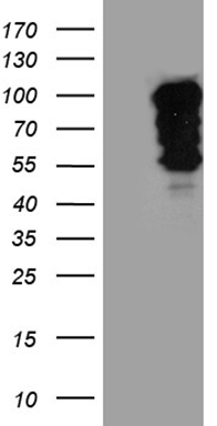 GSTZ1 Antibody