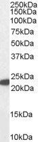 Glutathione Peroxidase 1 (isoform1) Antibody