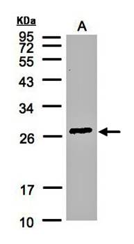 glutathione S-transferase alpha 2 Rabbit Polyclonal Antibody