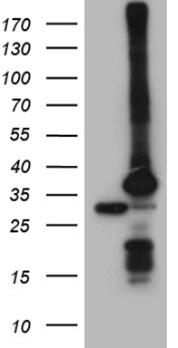 GM CSF Antibody