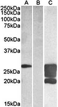 GM2A (aa 164-175) Antibody
