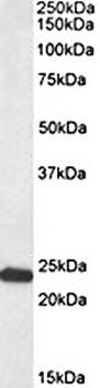 GM2A (aa 164-175) Antibody