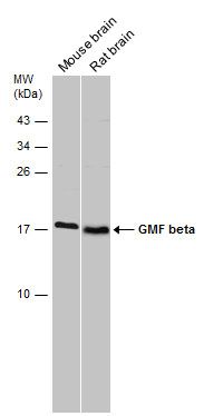 GMF beta Rabbit Polyclonal Antibody