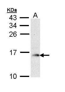 GMF beta Rabbit Polyclonal Antibody