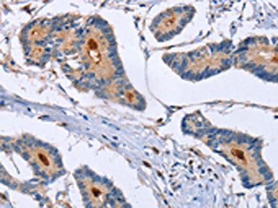 GMFG Antibody