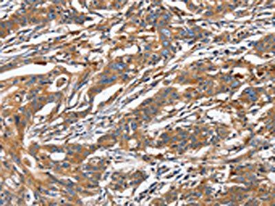 GNA13 Antibody