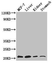 GNPNAT1 Antibody