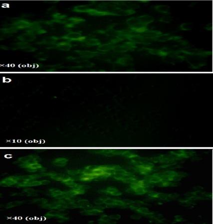 GnRHR Rabbit Polyclonal Antibody (FITC)