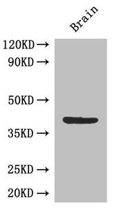 GOLM1 Antibody