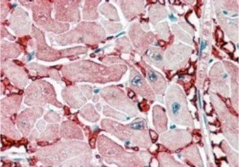 GOT1 (aa 157-167) Antibody