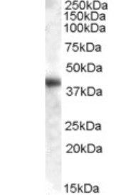 GOT1 (aa 157-167) Antibody