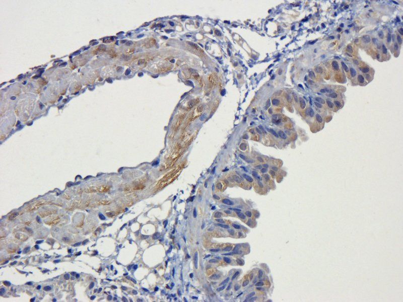 GP1BA Rabbit Polyclonal Antibody