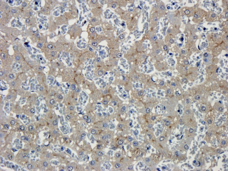 GP1BA Rabbit Polyclonal Antibody