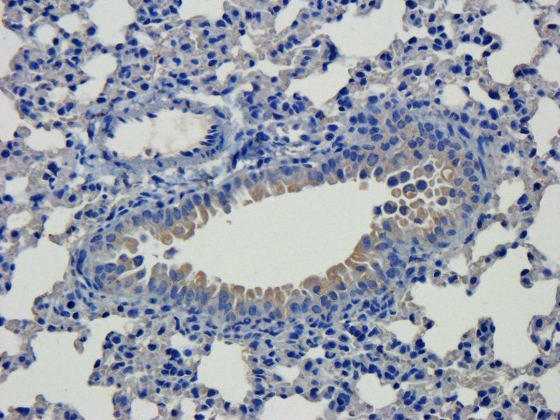 GP1BA Rabbit Polyclonal Antibody