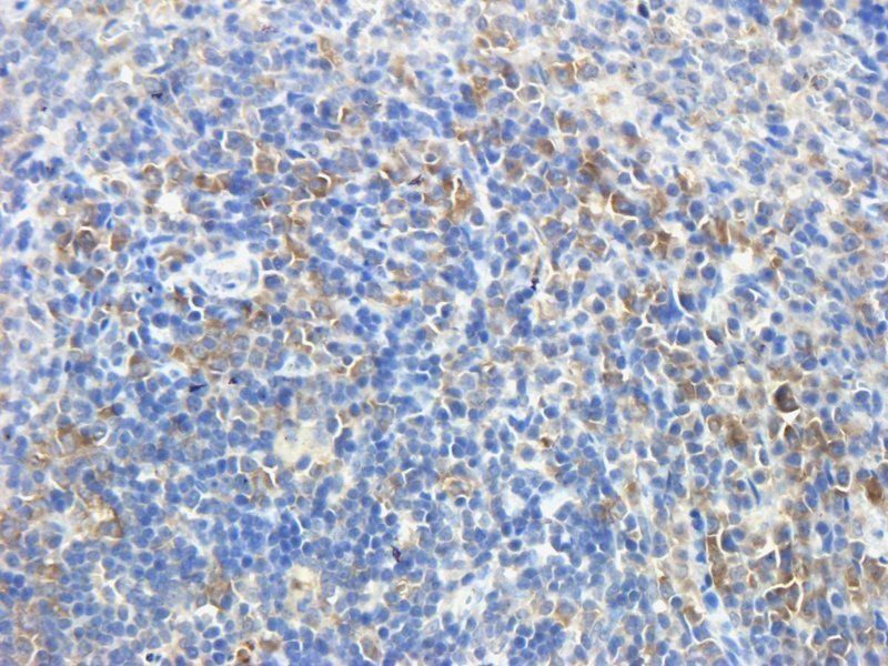 GP1BA Rabbit Polyclonal Antibody