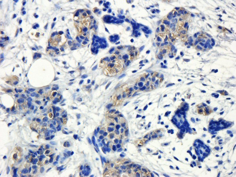 GP1BA Rabbit Polyclonal Antibody