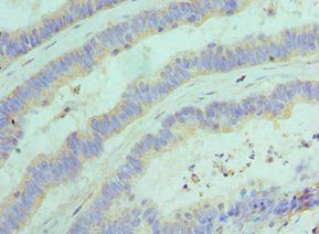 GOLM1 Antibody