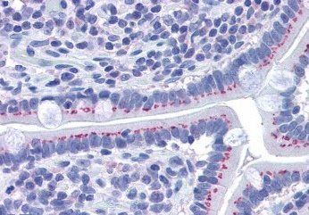 Goat anti-GOLPH2 Antibody