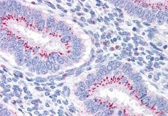 Goat anti-GOLPH2 Antibody