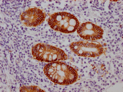 GPA33 Antibody
