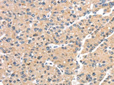 GPD2 Antibody
