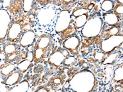 GPD2 Antibody