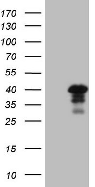 GPNMB Antibody