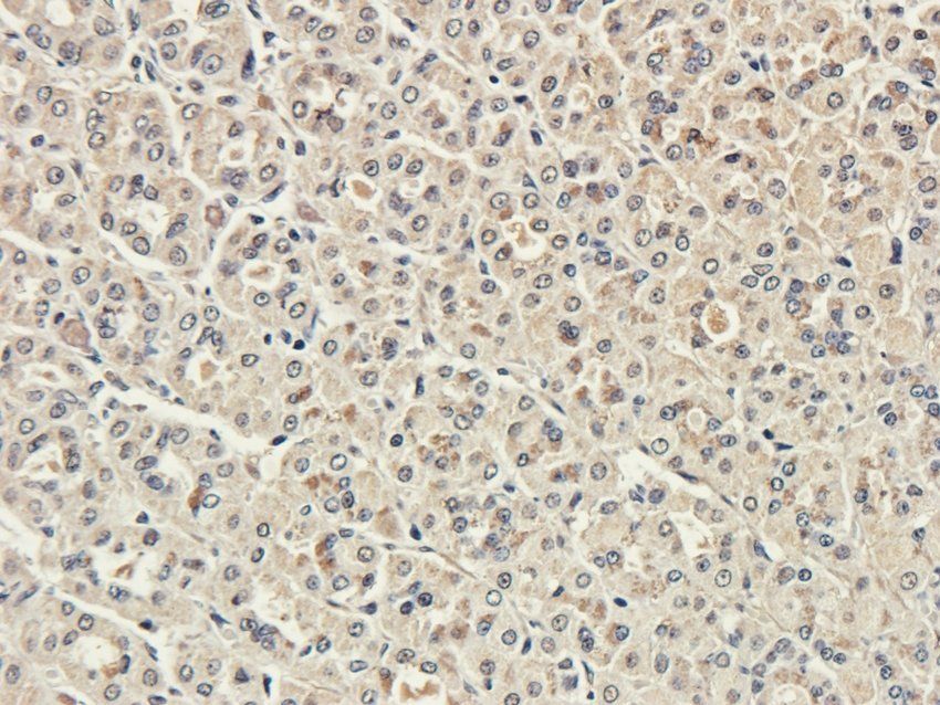 GPR35 Rabbit Polyclonal Antibody