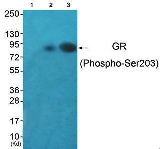 GR (Phospho-Ser203) Antibody