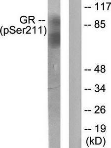 GR (Phospho-Ser211) Antibody