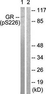 GR (Phospho-Ser226) Antibody