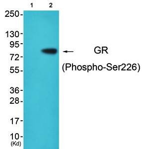GR (Phospho-Ser226) Antibody