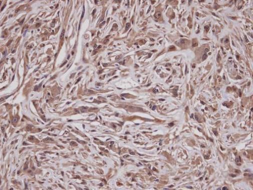 GRAP Rabbit Polyclonal Antibody
