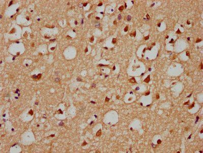 GRHL1 Antibody