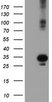 GRHPR Antibody