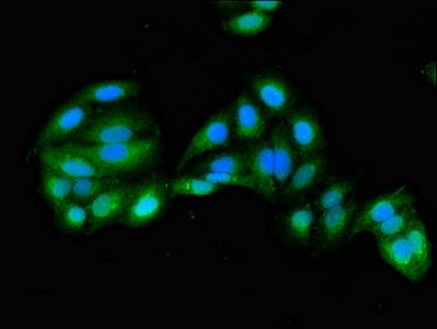 GRHPR Antibody