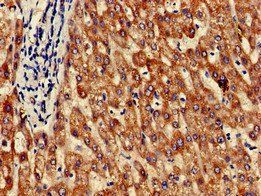 GRHPR Antibody