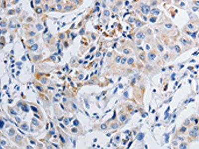 GRIA3 Antibody