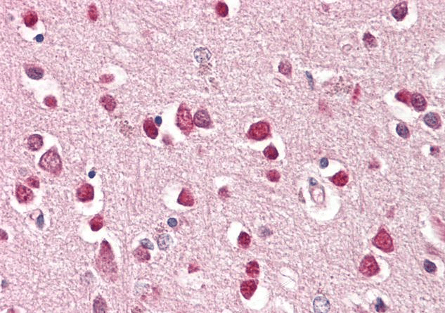 GLuR5/GRIK1 Antibody