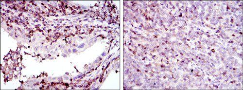 GRK2 Antibody