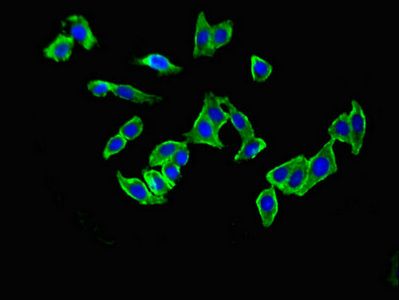 GRM1 Antibody