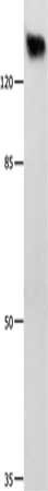GRM1 Antibody