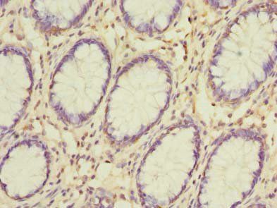 GSDMB Antibody