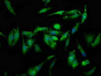 GSPT1 Antibody