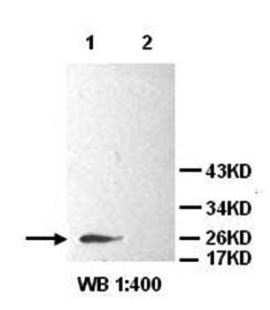 GST Rabbit Polyclonal Antibody