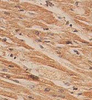 GST Rabbit Polyclonal Antibody