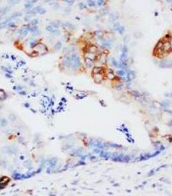 GST3/GST pi/GSTP1 Rabbit Polyclonal Antibody