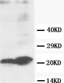 GST3/GST pi/GSTP1 Rabbit Polyclonal Antibody