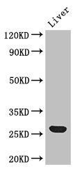 GSTA1 Antibody