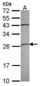 GSTA4 antibody [N1C3]